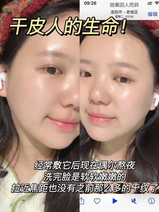 点击购买！o.metoo黄龙胆紧致抗皱乳敷面膜 商品图10