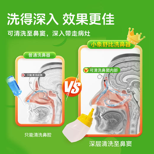 11【品牌直发】小象舒比防回流技术鼻腔冲洗器海盐水深度护鼻儿童家用护理5岁以上 商品图4
