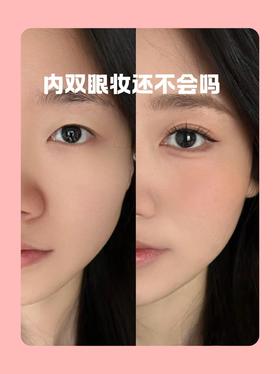 👁内双大眼公式｜自然术