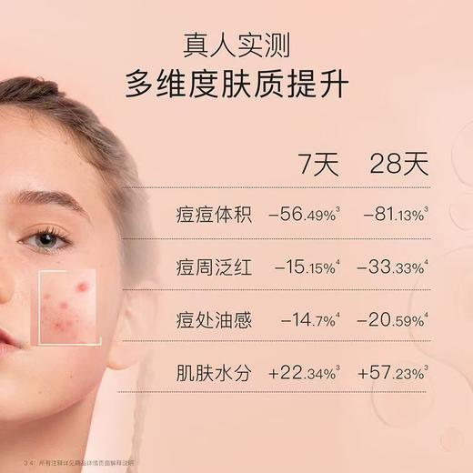 贝德美青少年儿童面霜祛除痘印保湿滋润痘痘修护精华霜 商品图2