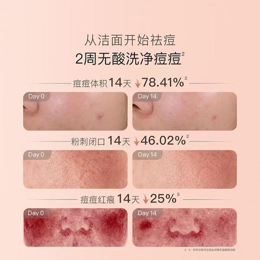 贝德美青少年洁面乳控油祛痘儿童洗面奶无酸温和 商品图4