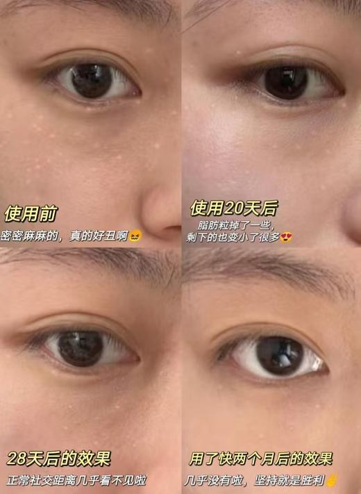 1支/2支【 升级版】日本去脂肪粒眼霜眼周专用精华液8g/支 A-4425 商品图8