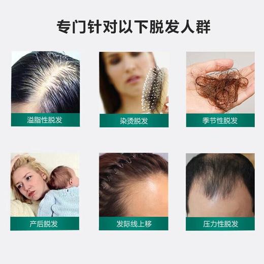 卡蓓诺防脱洗发水（损伤性脱发）350mL/瓶 商品图3