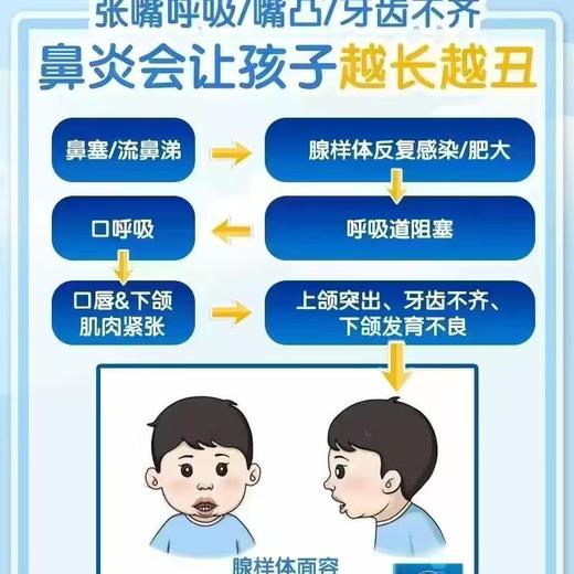 NCsoforee苏芙息益生菌固体饮料20g 商品图1