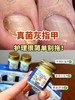 【JXSFT·泰国三秘方灰指甲】一抹30年灰指甲也有救 不复发不用包甲、不用拔甲、不影响日常走路人 好用奏效快，效果yyds 商品缩略图4