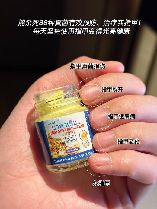 【JXSFT·泰国三秘方灰指甲】一抹30年灰指甲也有救 不复发不用包甲、不用拔甲、不影响日常走路人 好用奏效快，效果yyds 商品图2