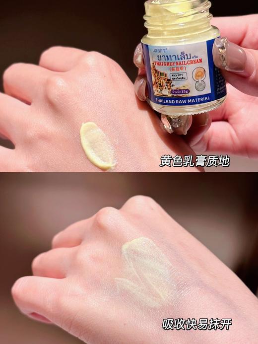 【JXSFT·泰国三秘方灰指甲】一抹30年灰指甲也有救 不复发不用包甲、不用拔甲、不影响日常走路人 好用奏效快，效果yyds 商品图3