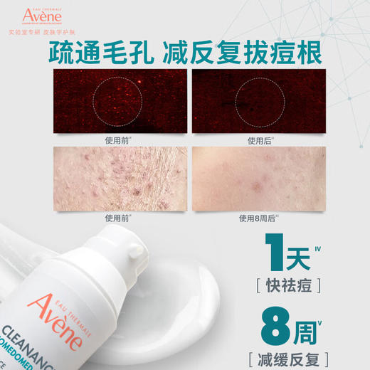 雅漾控油抗痘精华露 30ml 商品图1