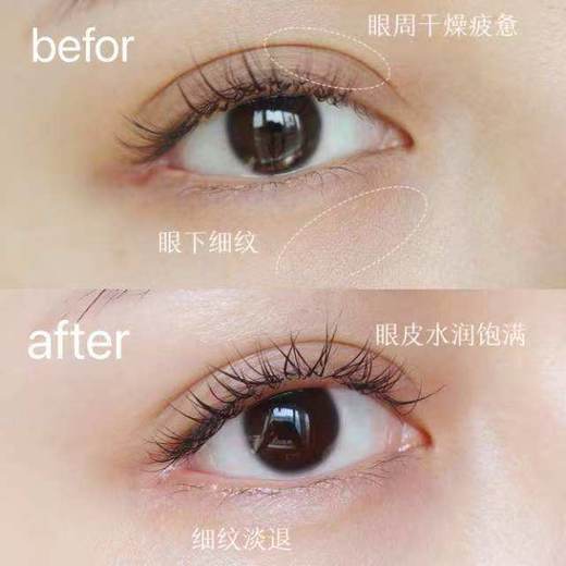 以中药养眼正品EMWM黄芪抗皱眼部精华油 商品图11