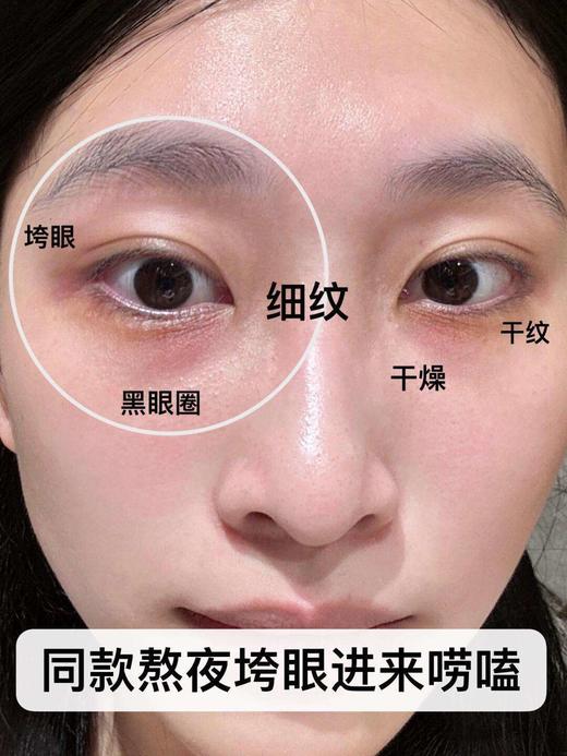 以中药养眼正品EMWM黄芪抗皱眼部精华油 商品图9