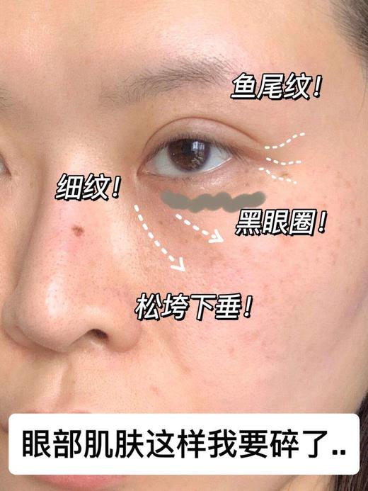 以中药养眼正品EMWM黄芪抗皱眼部精华油 商品图10