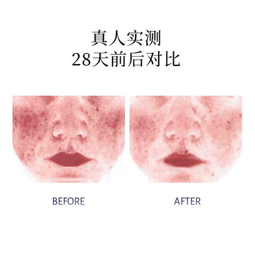 普丽兰三文鱼修护精华面霜50g 面部保湿修护舒缓泛红 商品图5