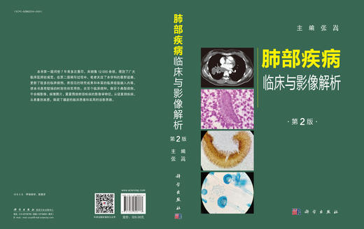 肺部疾病临床与影像解析（第二版）/张嵩 商品图2