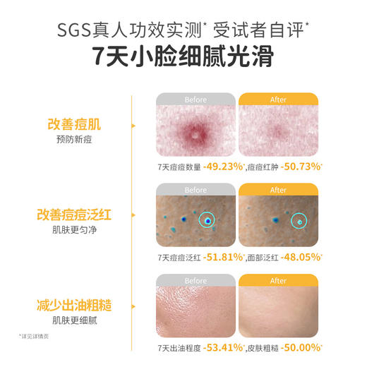 【青少年祛痘面膜】局部精准祛痘 全脸修护痘损 袋鼠妈妈净痘修护面膜-24.5mlx5片 商品图3