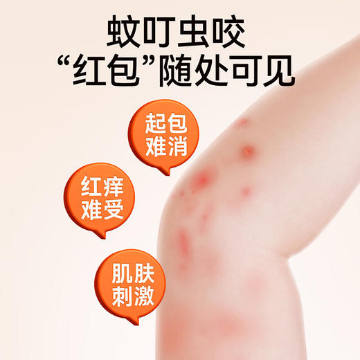 【夏季主推爆品】亲初 止痒修护 小绿膏 16g 商品图1