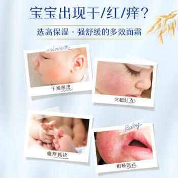 艾惟诺（Aveeno）艾维诺婴儿面霜 秋冬多效护理儿童润肤乳霜舒缓干痒红修护霜141g 商品图1