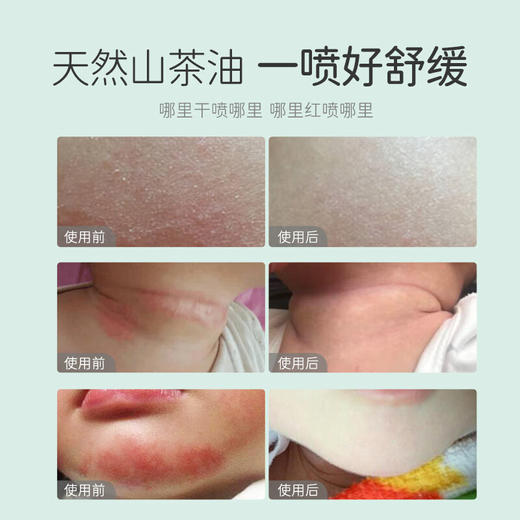 松达婴儿护肤山茶油霜儿童宝宝润肤霜/SD-00252松达护肤山茶油 50ml/SD-00122 商品图4