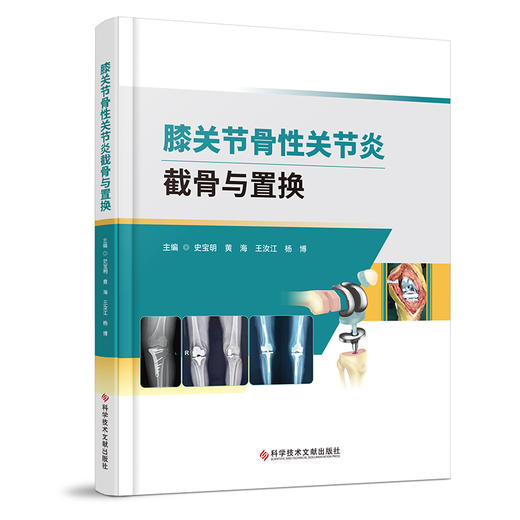 膝关节骨性关节炎截骨与置换  主编 史宝明  文献出版 商品图0