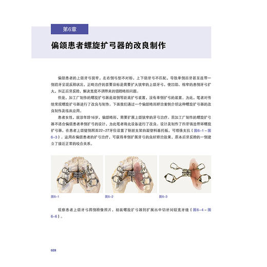 实用口腔正畸小妙招 武广增 主编 涵盖35种临床病例类型 配合千余张临床照片及操作示意图 辽宁科学技术出版社9787559141378 商品图3