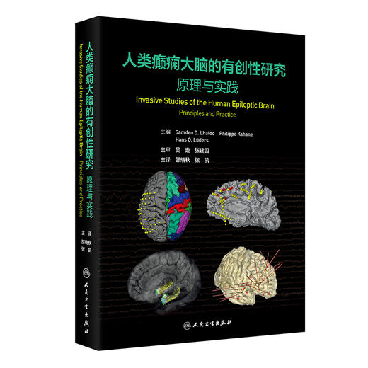 人类癫痫大脑的有创性研究 原理与实践 邵晓秋 张凯 主译 该书系统介绍了癫痫灶和大脑功能区的定位原理和方法等 人民卫生出版社 商品图1