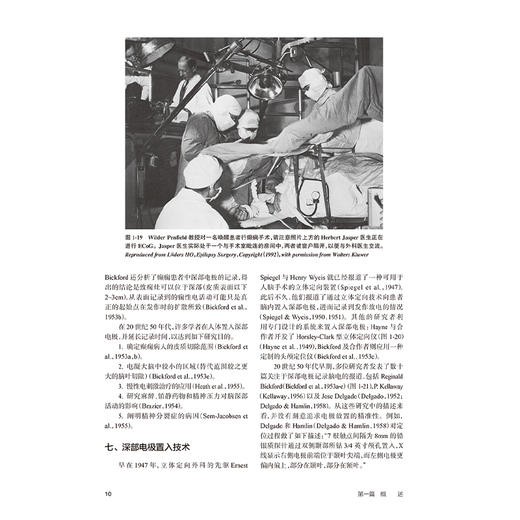 人类癫痫大脑的有创性研究 原理与实践 邵晓秋 张凯 主译 该书系统介绍了癫痫灶和大脑功能区的定位原理和方法等 人民卫生出版社 商品图4