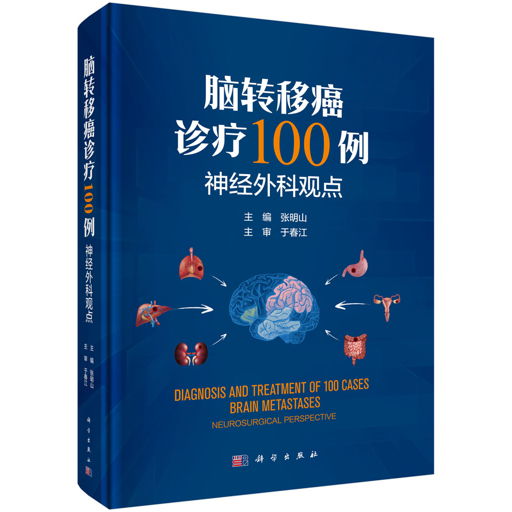 脑转移癌诊疗100例——神经外科观点