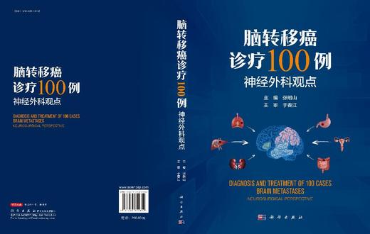 脑转移癌诊疗100例——神经外科观点 商品图3