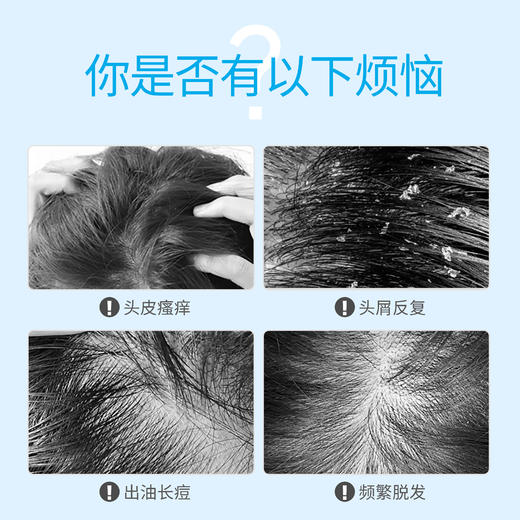 绽妍舒缓头皮精华液45ml 效期2026年3月 商品图1