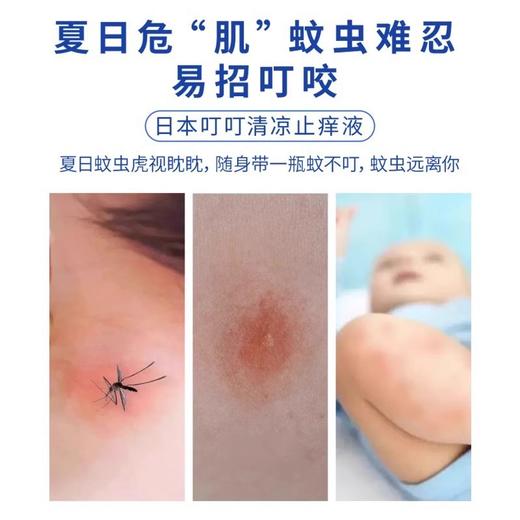 【拍1发2！夏日必备！🌿】10秒止痒+天然草本呵护！随身一瓶日本叮叮，蚊虫不叮你🦟✨日本叮叮清凉止痒液 清爽凉快便携装蚊虫叮咬 家用涂抹液走珠50ml 商品图1