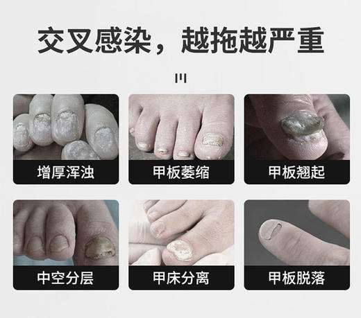 护甲凝胶39.8元3只，预售2-3天到货 商品图12