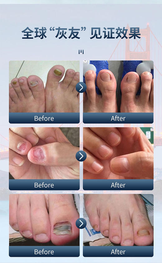 护甲凝胶39.8元3只，预售2-3天到货 商品图6