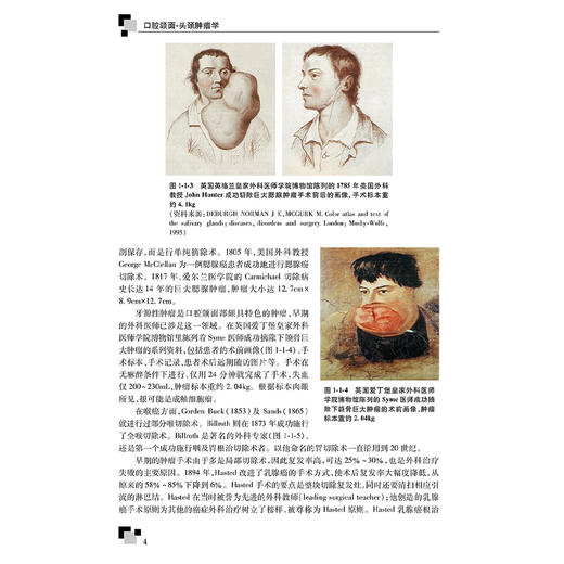 口腔颌面 头颈肿瘤学 第2二版 十三五规划教材全国高等学校研究生规划教材| 俞光岩 主编 供口腔医学类专业用 人民卫生出版社   商品图4