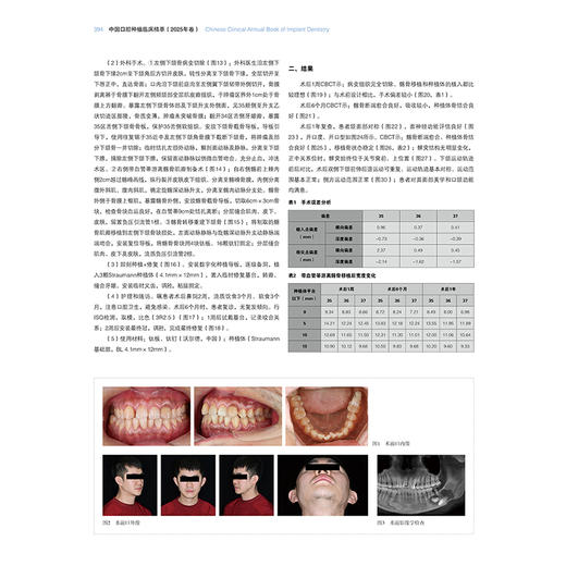 中国口腔种植临床精萃 2025年卷 王兴 刘宝林 第13次BITC口腔种植病例大赛将获奖病例收集成册 辽宁科学技术出版社 商品图4