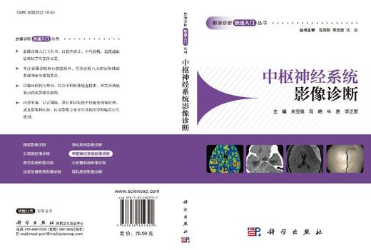 中枢神经系统影像诊断/影像诊断快速入门丛书 商品图3