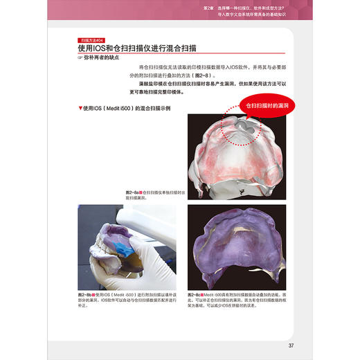 【出版社直发】数字化全口吸附性义齿新时代 山崎史晃 著 扫描仪和软件差异分析义齿制作方法口腔美容种植 辽宁科学技术出版社 商品图4