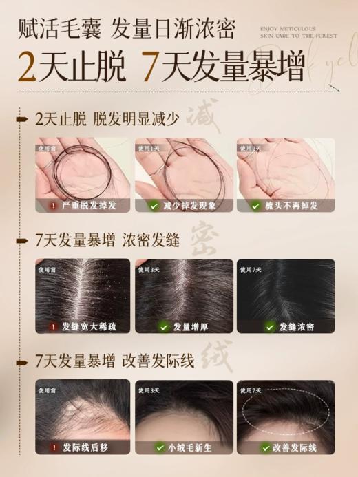 儒意育发液头发际线营养剂 100ml 商品图4