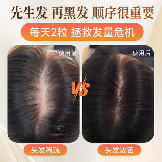 世界选物官密发宝固发多发铁锌矽镁生物素30粒/盒 商品图1