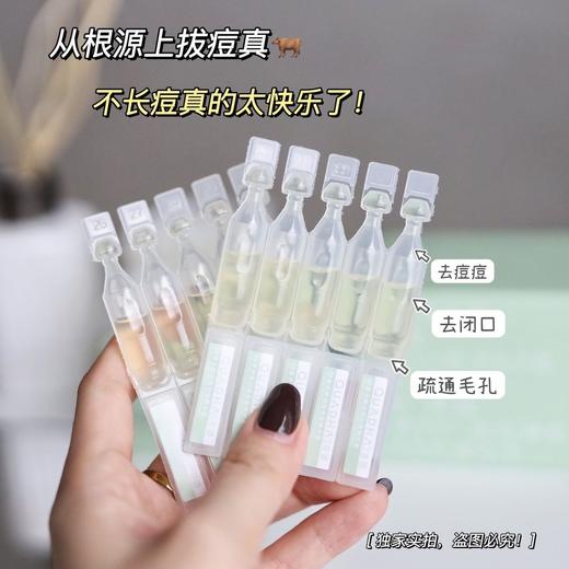 限时限量!破价薅到手软【夸迪 精华液5支装集合】针对肤质 专项解决 商品图2