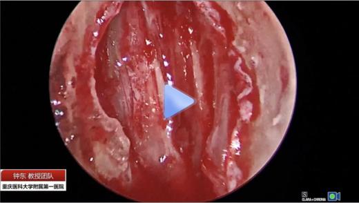 听瘤内镜操作部分 商品图0