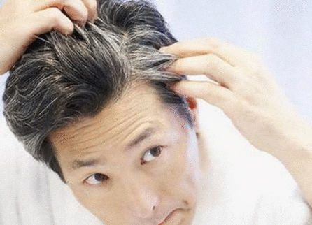 白发养黑不用染 ，告别化学染发！这款纯中药草本研发的乌发精华液绝了！ 