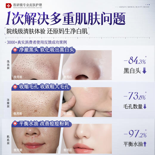 儒意净透控油去黑头泥膜130g  清洁泥膜去黑头粉刺闭口收缩毛孔水杨酸涂抹面膜|儒意官方商城 商品图1