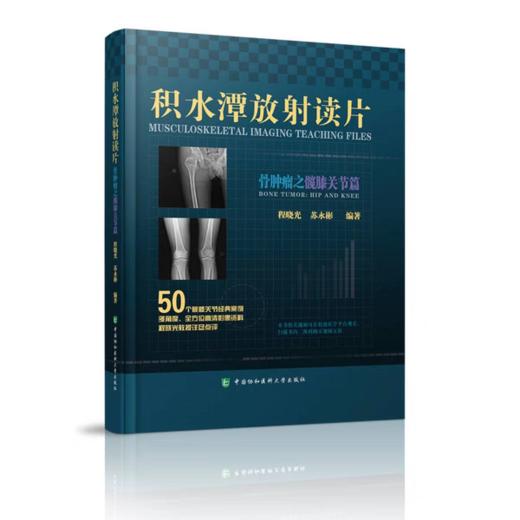 积水潭放射读片 骨肿瘤之腕踝关节篇+骨肿瘤之髋膝关节篇+骨肿瘤之肩肘关节篇+骨肿瘤之中轴骨篇 商品图2