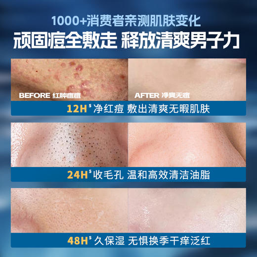 儒意男士水杨酸净颜面膜10片/盒  水杨酸控油祛痘面膜 淡化痘印收缩毛孔补水美白男士专用 |儒意官方商城 商品图1