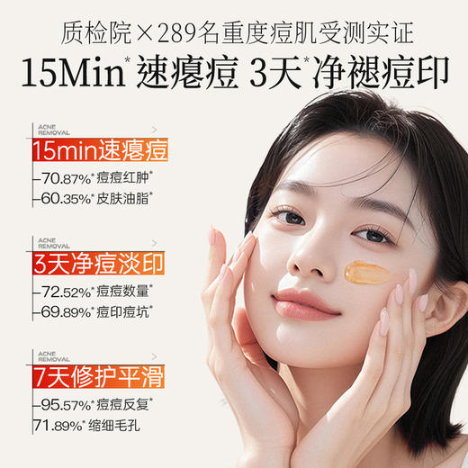 儒意复合酸焕肤调理面膜50g  祛痘面霜淡化痘印控油收缩毛孔水杨酸|儒意官方商城 商品图1