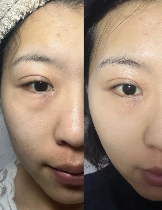 【5.17王炸割肉价】娇韵诗电眼精华立体眼霜15ml（简装无盒 效期至26.3） 商品图3