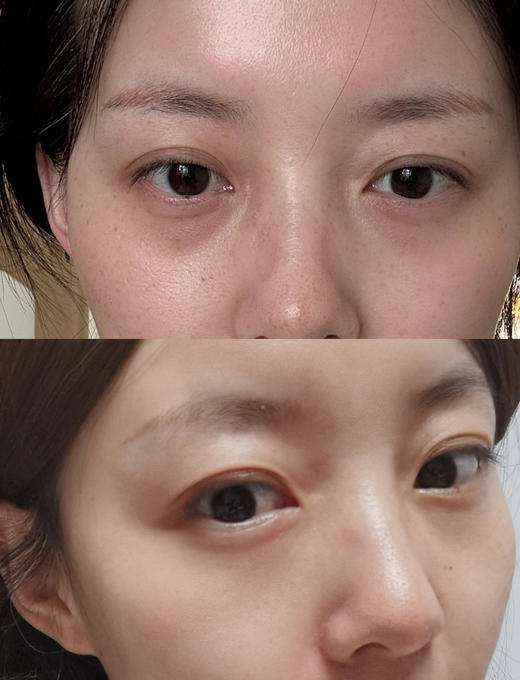 【5.17王炸割肉价】科颜氏紫玻A眼霜28ml 无盒（效期至25.11） 商品图5