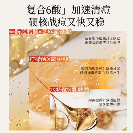 儒意复合酸焕肤调理面膜50g  祛痘面霜淡化痘印控油收缩毛孔水杨酸|儒意官方商城 商品图2