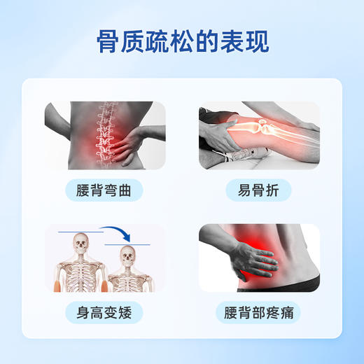 骨质疏松 健康管理 套餐-进口密固达 商品图2
