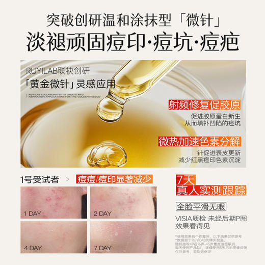 儒意复合酸焕肤调理面膜50g  祛痘面霜淡化痘印控油收缩毛孔水杨酸|儒意官方商城 商品图3