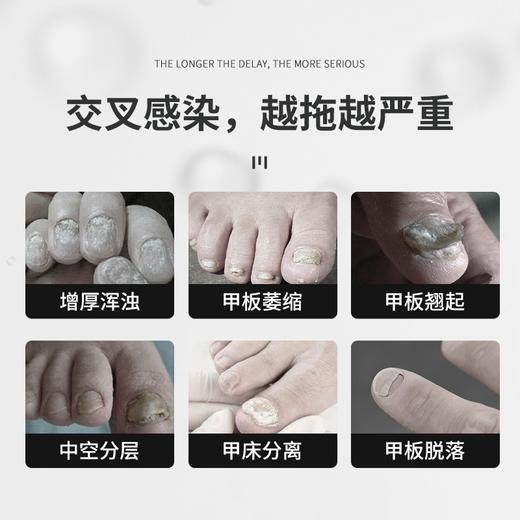 30年灰指甲也有救了 灰指甲“终结者”【美国RéMONA净甲修复凝胶】一抹即消，永不复发👏🏻来自美国医疗卫生研究所，汇集哈佛+耶鲁+斯坦福多位权威专家研制而出 商品图3
